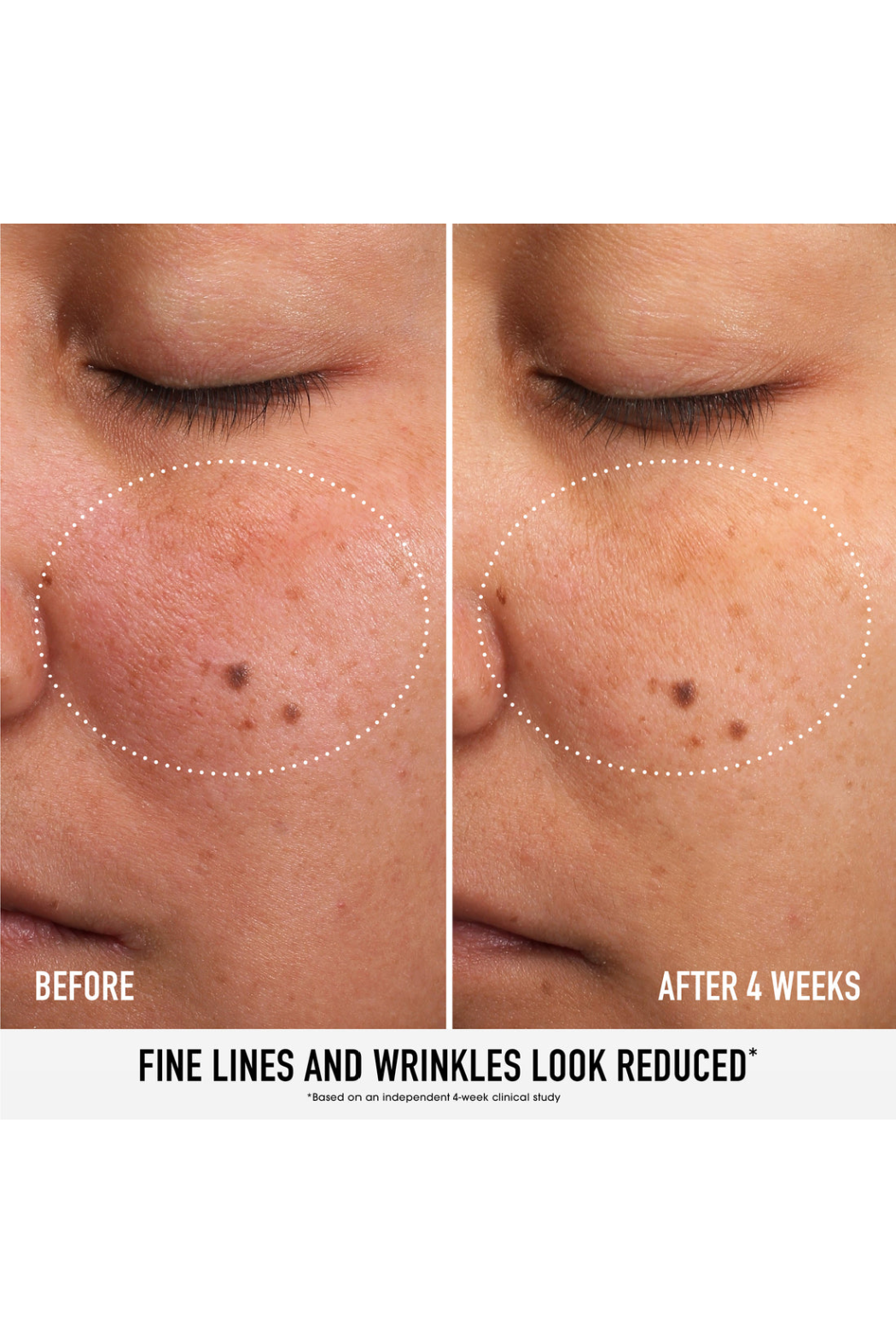 SKIN RESCUE Pure Smooth Serum with 5% Niacinamide and Chebula