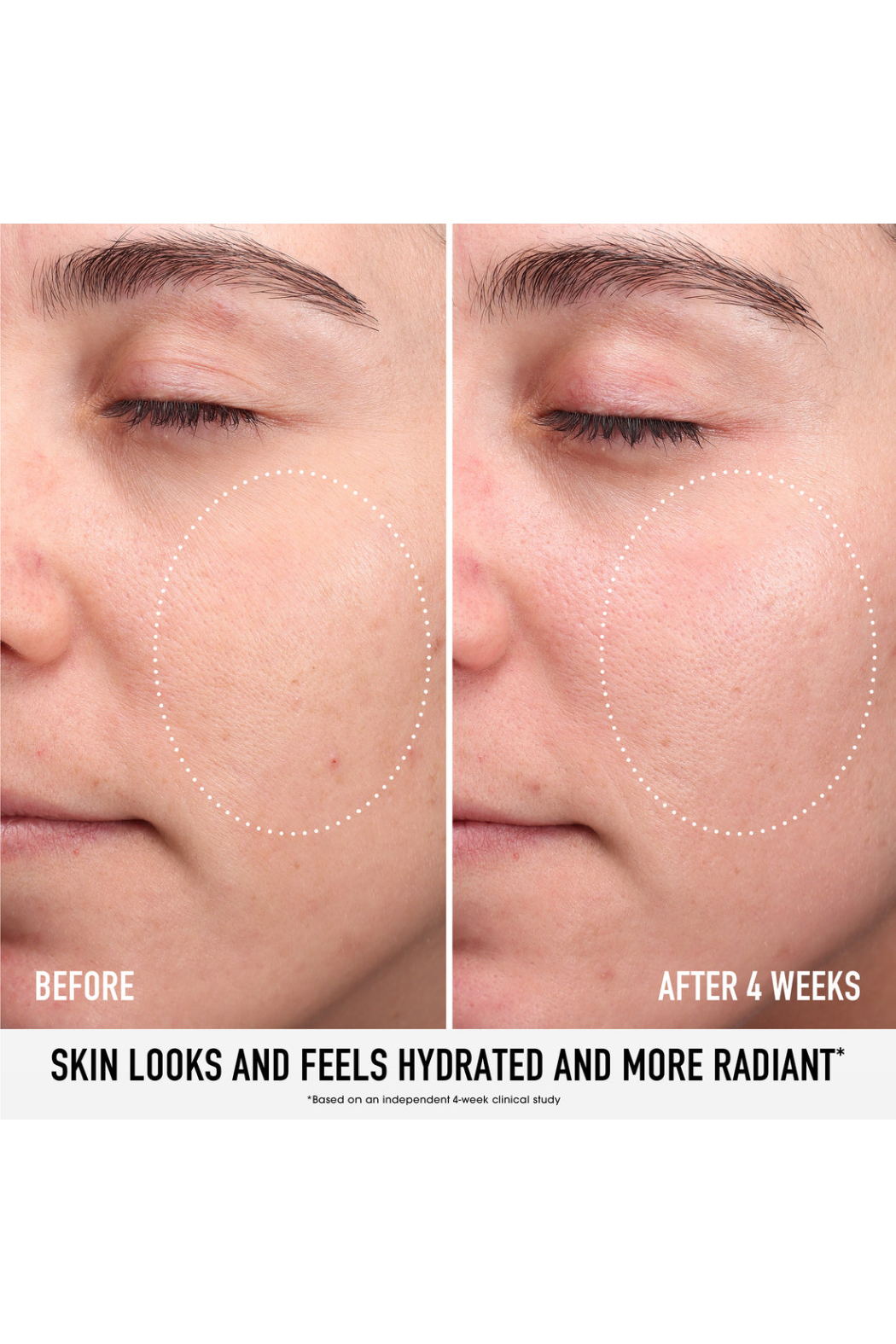 SKIN RESCUE Pure Moisture Serum with 1% PGA and Plant Algae